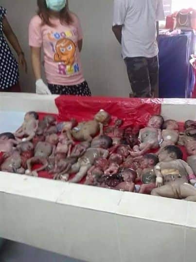fetus-market