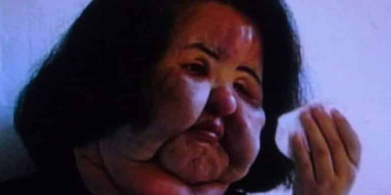 Former Model’s Addiction to Plastic Surgery Led to Devastating Results ...