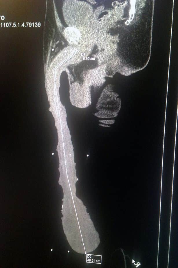 man-long-penis-3