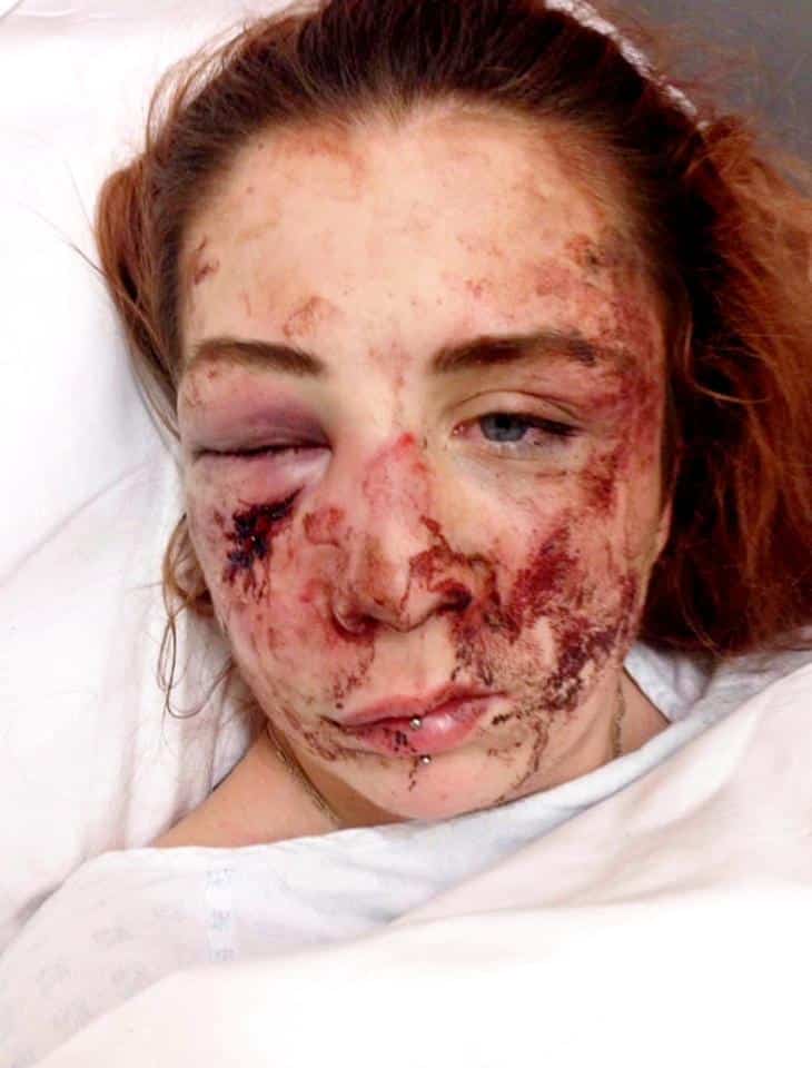 Emily O’Reilly was robbed and attacked on her way to a friend’s house.