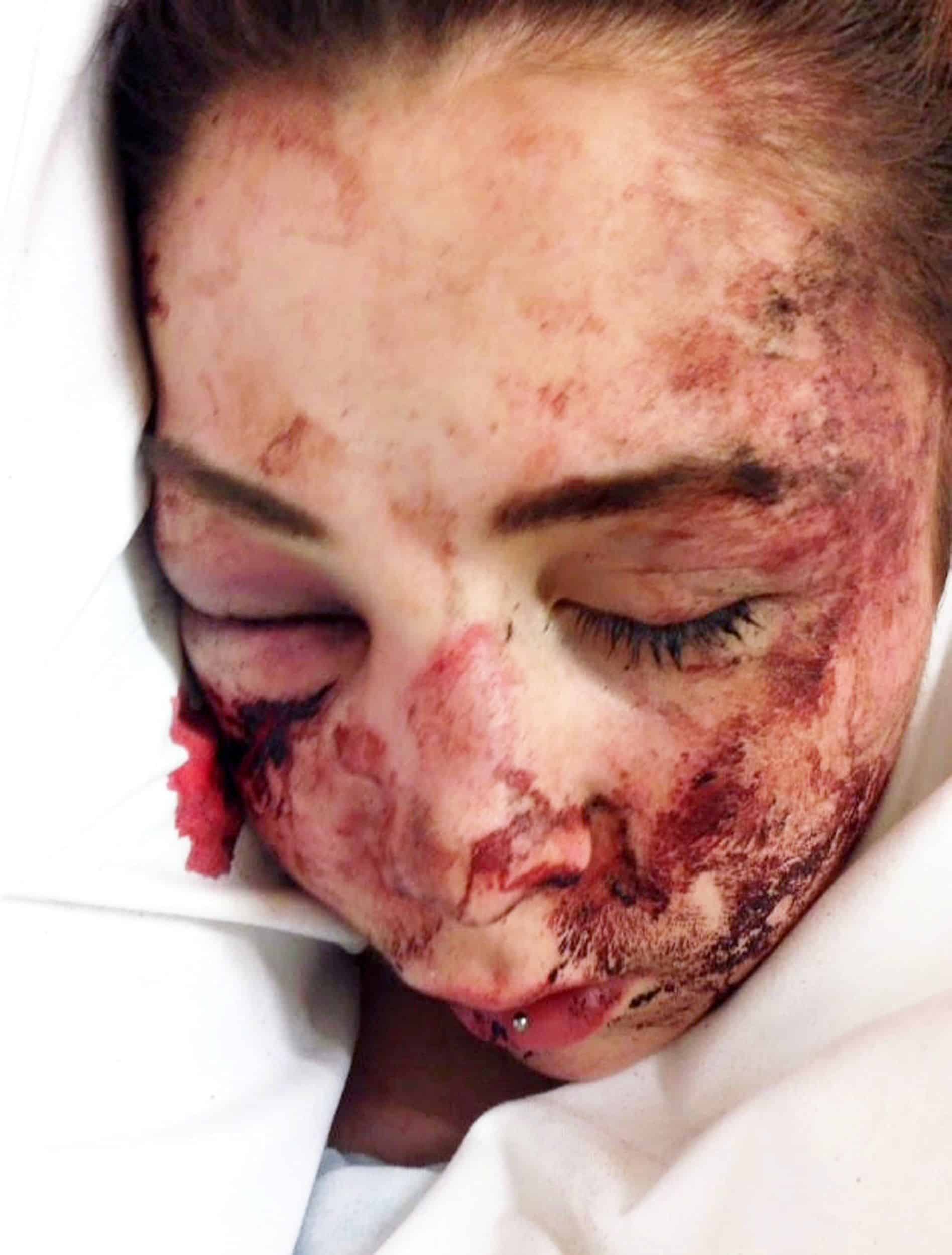 The assault on Emily only stopped when someone thought that she was already dead.