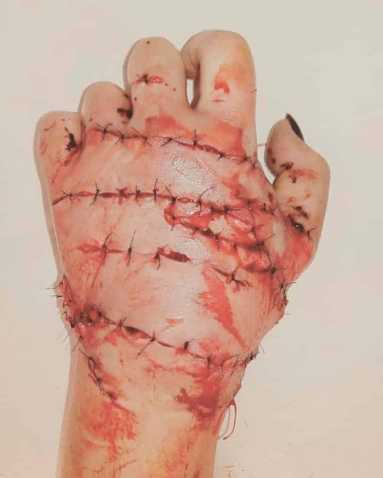 A photo of Margarita’s reconnected left hand was released.