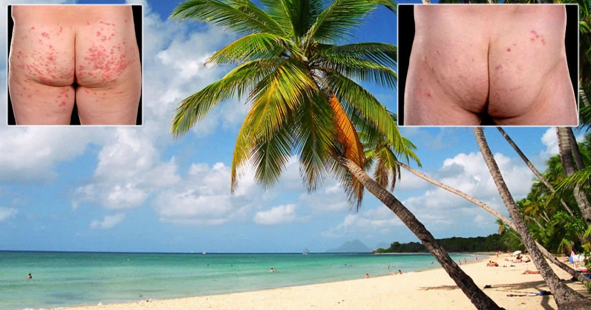 beach-couple-worm-infestation-featured