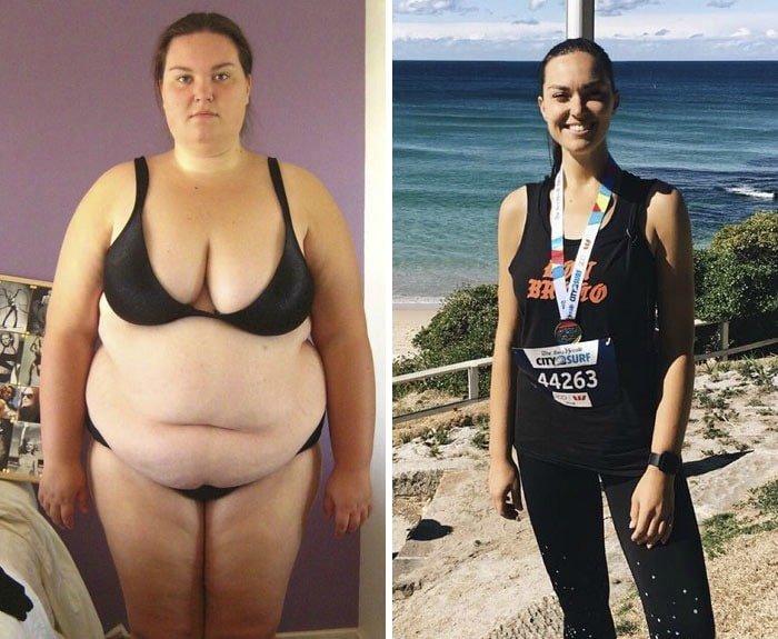 before after weight loss transformation_3